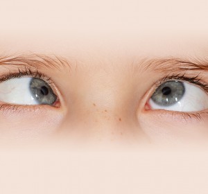 Seeing Straight: A Complete Guide to Understanding and Treating Squint