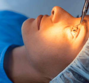 What You Need to Know About Implantable Contact Lens Surgery?