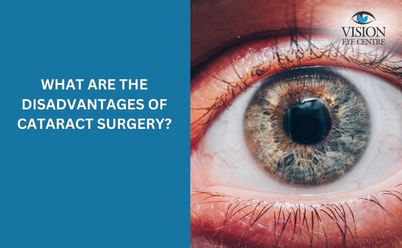 What are the disadvantages of cataract surgery?​
