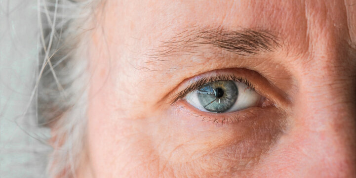 What is the Best Treatment for Glaucoma?