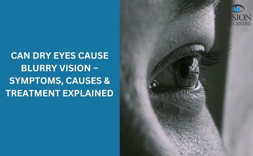 can dry eyes cause blurry vision – Symptoms, Causes & Treatment Explained
