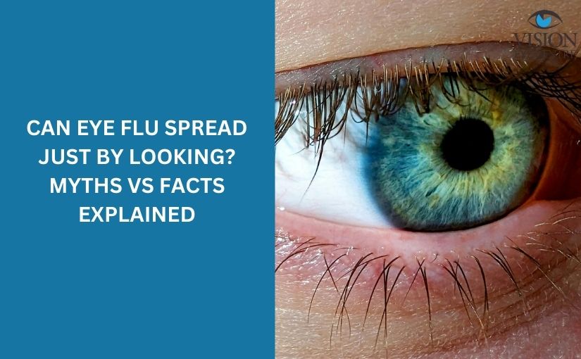 Can Eye Flu Spread Just by Looking? Myths vs Facts Explained