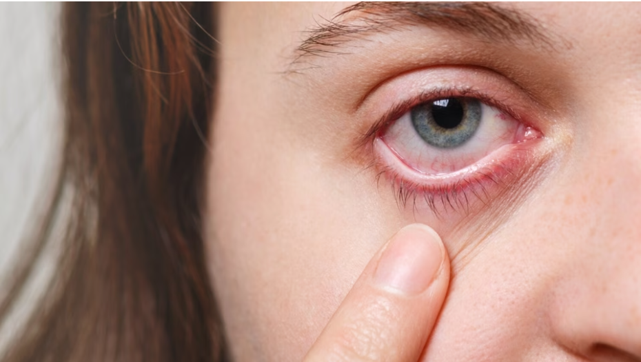 Dr. Grover Shares Expert Eye Care Tips to Protect Against Smog in Hindustan Times