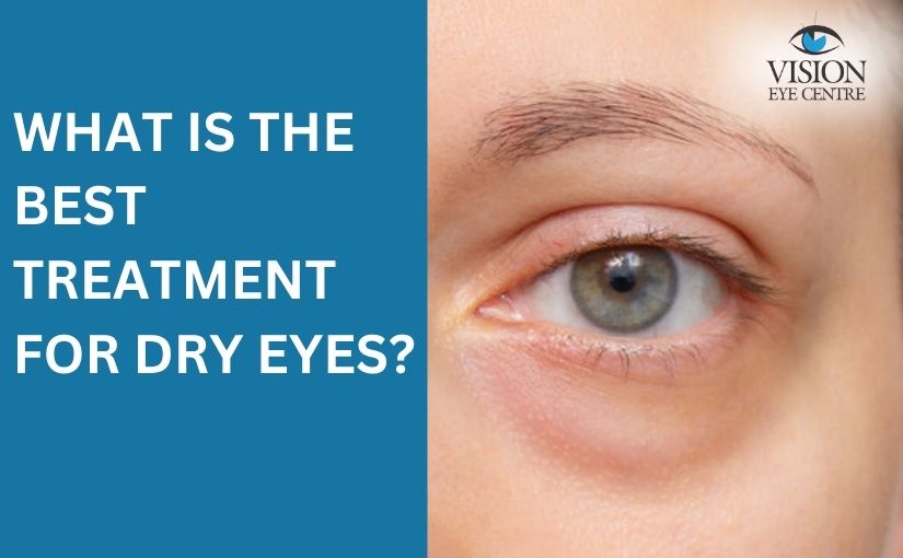 What is the Best Treatment for Dry Eyes?