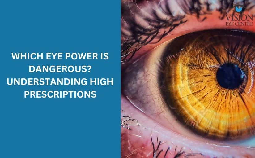 Which Eye Power is Dangerous? Understanding High Prescriptions