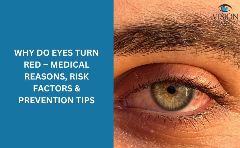 why do eyes turn red – Medical Reasons, Risk Factors & Prevention Tips