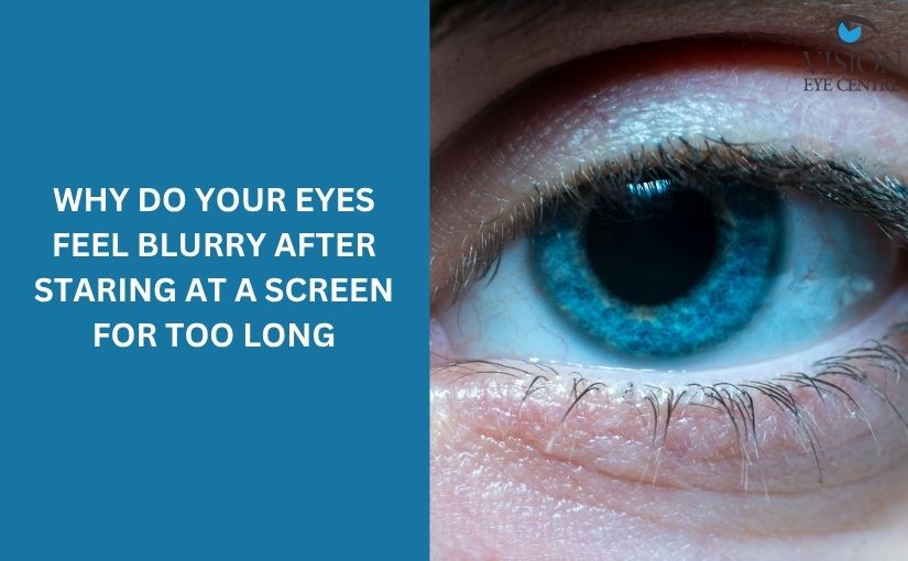 Why Do Your Eyes Feel Blurry After Staring at a Screen for Too Long